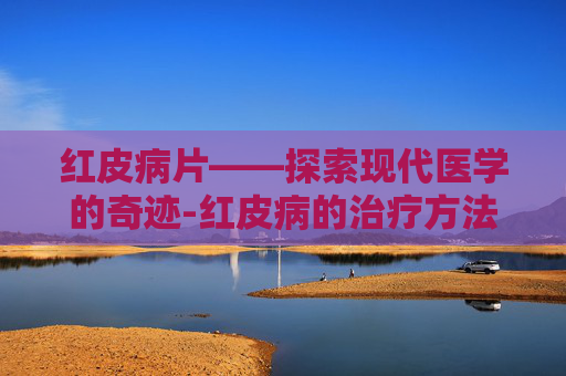 红皮病片——探索现代医学的奇迹-红皮病的治疗方法