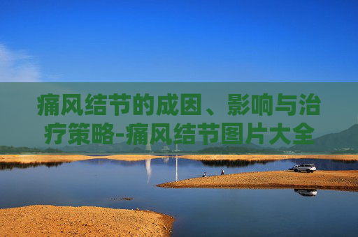 痛风结节的成因、影响与治疗策略-痛风结节图片大全