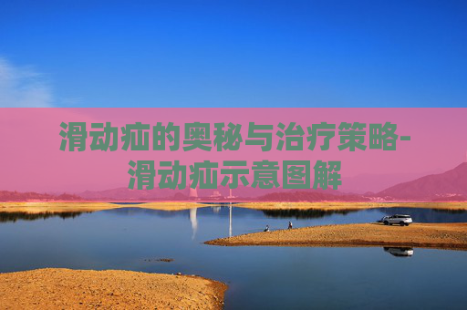 滑动疝的奥秘与治疗策略-滑动疝示意图解