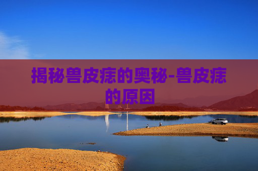 揭秘兽皮痣的奥秘-兽皮痣的原因