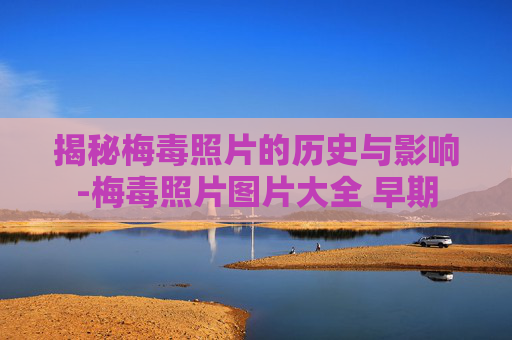 揭秘梅毒照片的历史与影响-梅毒照片图片大全 早期