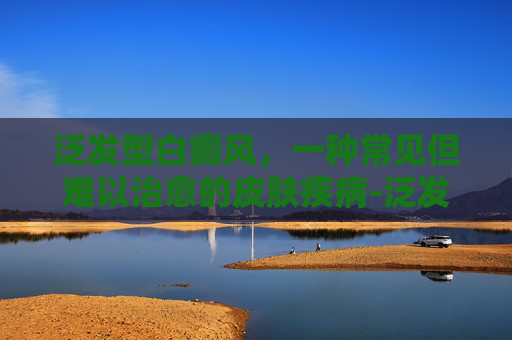 泛发型白癜风，一种常见但难以治愈的皮肤疾病-泛发型白癜风是什么意思