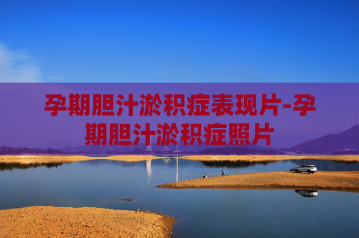 孕期胆汁淤积症表现片-孕期胆汁淤积症照片