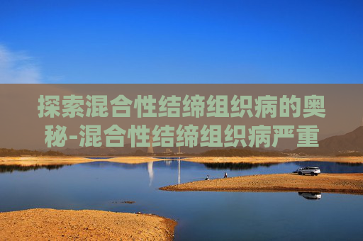 探索混合性结缔组织病的奥秘-混合性结缔组织病严重吗