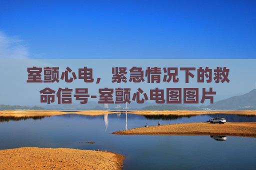 室颤心电，紧急情况下的救命信号-室颤心电图图片