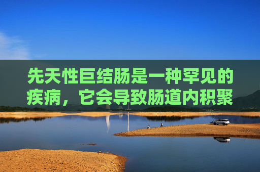 先天性巨结肠是一种罕见的疾病，它会导致肠道内积聚大量粪便，从而引起一系列症状。以下是关于先天性巨结肠的症状介绍，-宝宝先天性巨结肠有什么症状