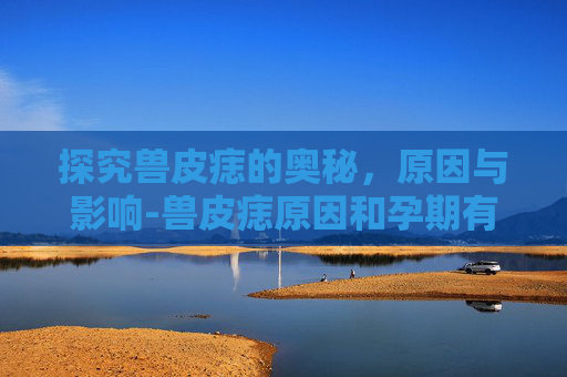 探究兽皮痣的奥秘，原因与影响-兽皮痣原因和孕期有关吗