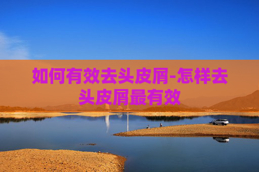 如何有效去头皮屑-怎样去头皮屑最有效