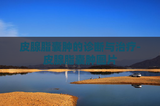 皮腺脂囊肿的诊断与治疗-皮腺脂囊肿图片