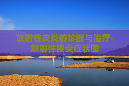 放射性皮炎的诊断与治疗-放射性皮炎症状图