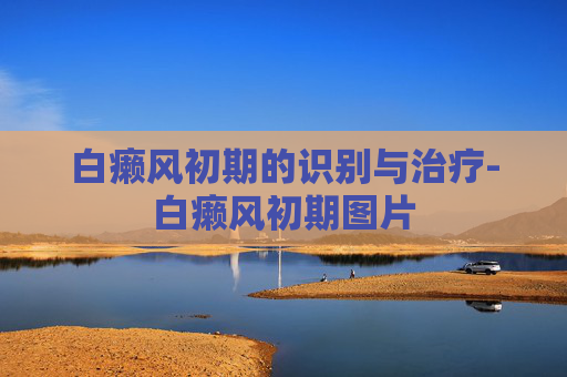 白癞风初期的识别与治疗-白癞风初期图片 白癞风初期的识别与治疗-白癞风初期图片