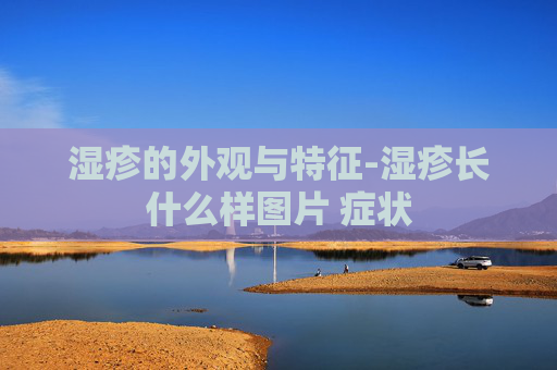 湿疹的外观与特征-湿疹长什么样图片 症状
