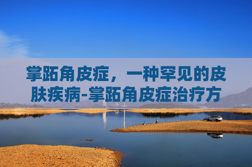 掌跖角皮症，一种罕见的皮肤疾病-掌跖角皮症治疗方法