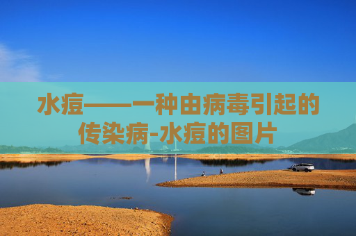 水痘——一种由病毒引起的传染病-水痘的图片