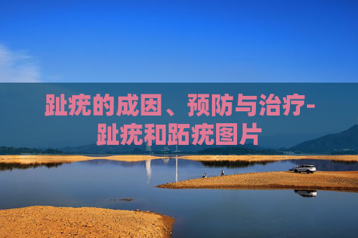 趾疣的成因、预防与治疗-趾疣和跖疣图片