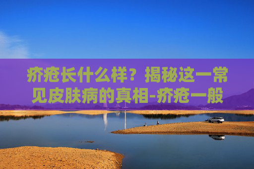 疥疮长什么样?揭秘这一常见皮肤病的真相-疥疮一般长在哪些部位 疥疮长什么样?揭秘这一常见皮肤病的真相-疥疮一般长在哪些部位