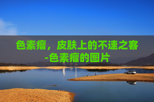 色素瘤,皮肤上的不速之客-色素瘤的图片 色素瘤,皮肤上的不速之客-色素瘤的图片