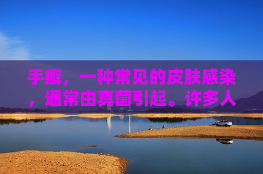 手癣，一种常见的皮肤感染，通常由真菌引起。许多人关心的是，手癣是否会自愈。本文将探讨这一问题，并提供一些建议和信息。-怎么判断是不是手癣