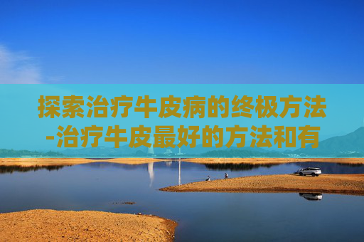 探索治疗牛皮病的终极方法-治疗牛皮最好的方法和有效的药