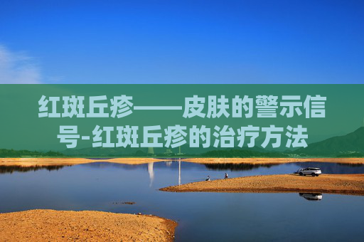 红斑丘疹——皮肤的警示信号-红斑丘疹的治疗方法