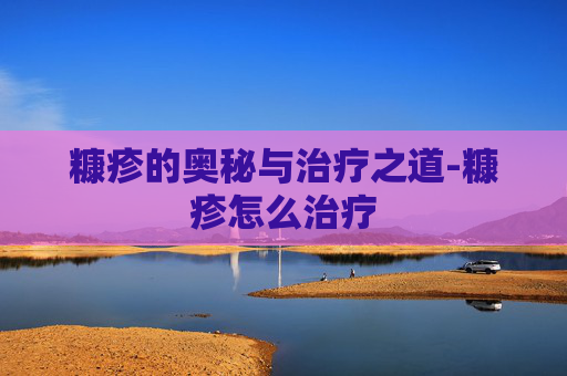 糠疹的奥秘与治疗之道-糠疹怎么治疗