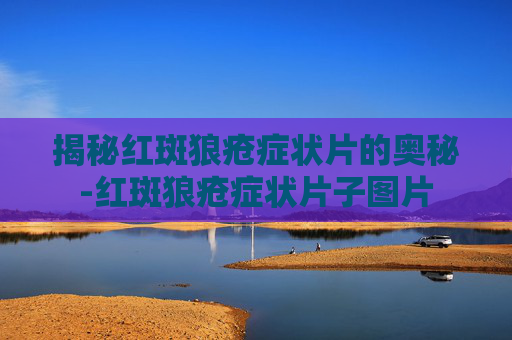 揭秘红斑狼疮症状片的奥秘-红斑狼疮症状片子图片