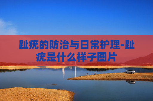 趾疣的防治与日常护理-趾疣是什么样子图片
