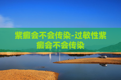 紫癜会不会传染-过敏性紫癜会不会传染